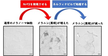 転写因子NRF3による新たなメラニン産生機構と、その阻害剤としてネルフィナビルの有効性