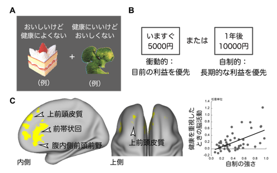 2024_no20_press_脳研_共同リリース.png   (102842)